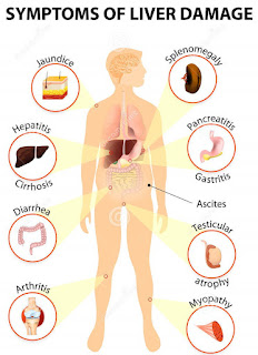 Symptoms of liver infection