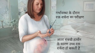 gestational diabetes hindi