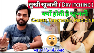 सूखी खुजली के कारण,लक्षण,इलाज,बचाव क्या है- Causes,symptoms, treatment of dry itching,prevention in Hindi-Medical Jankari